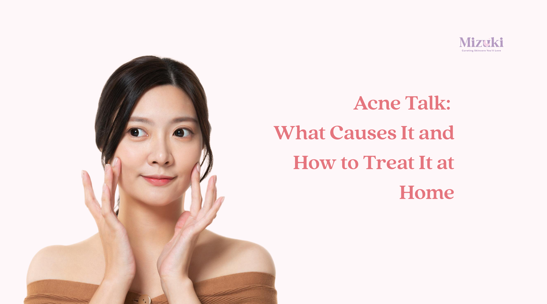 Acne Talk: What Causes It and How to Treat It at Home